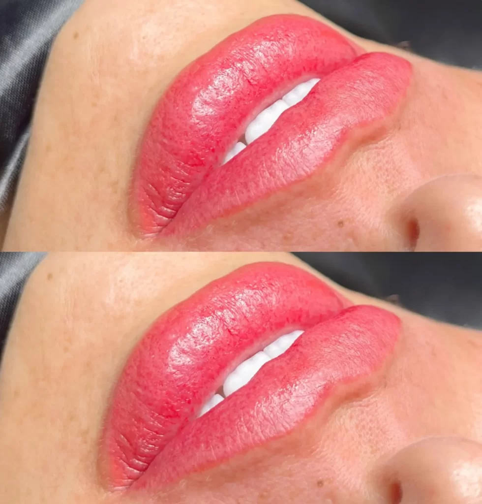 blood thinners before lip tattoo