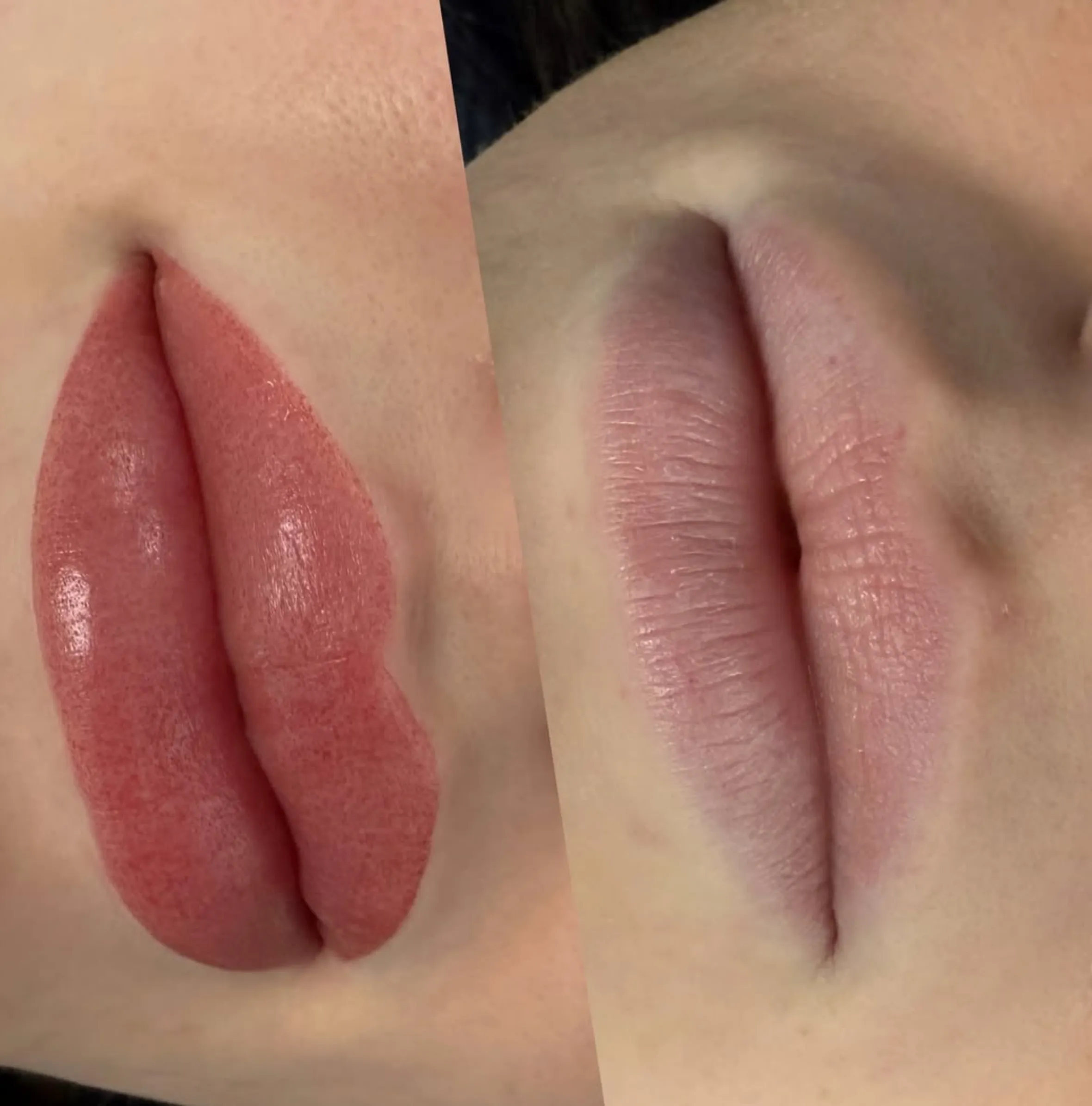 cold sore prevention before lip tattoo