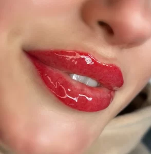lip fillers before lip tattoo