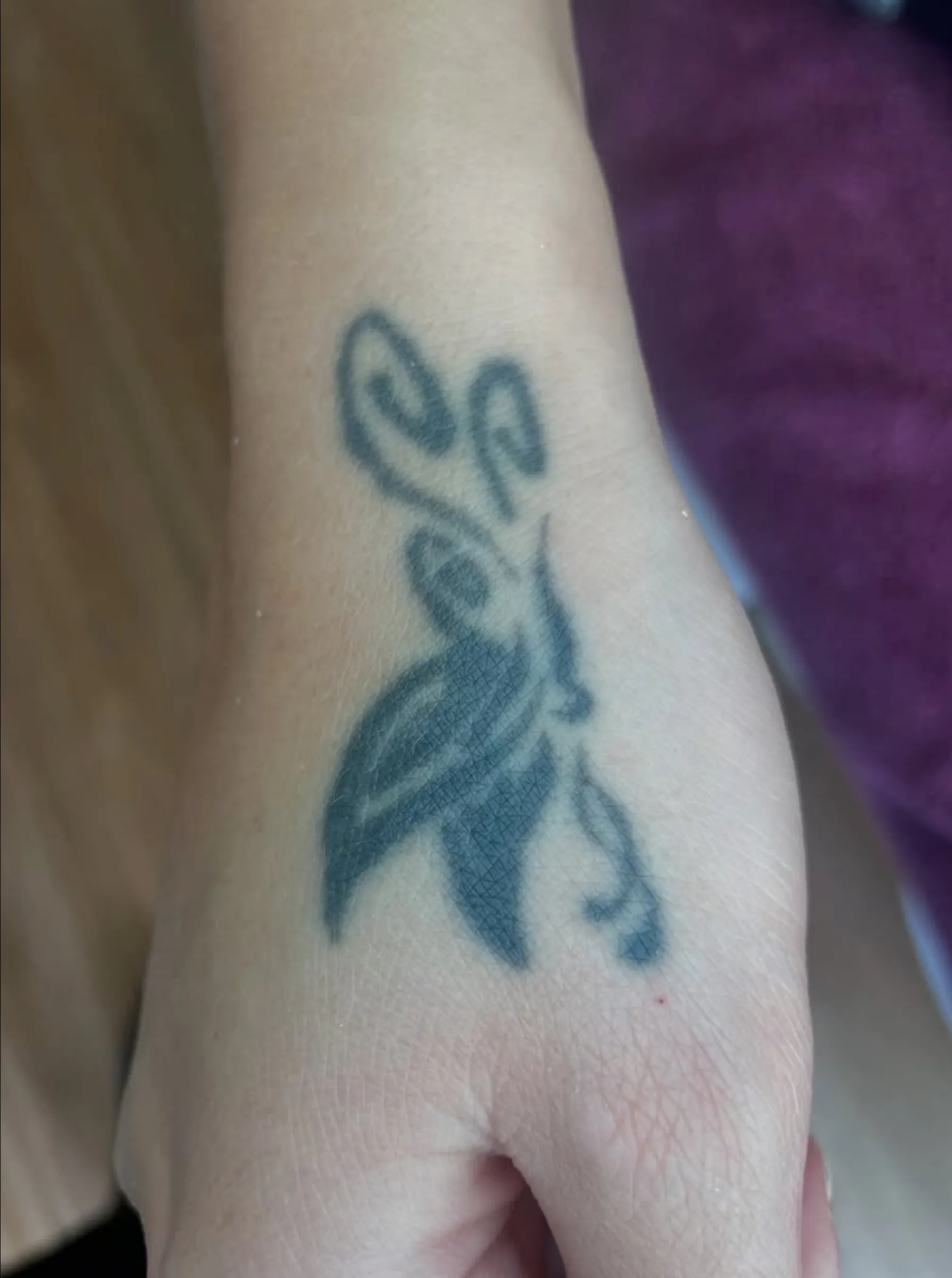 eyebrow tattoo removal