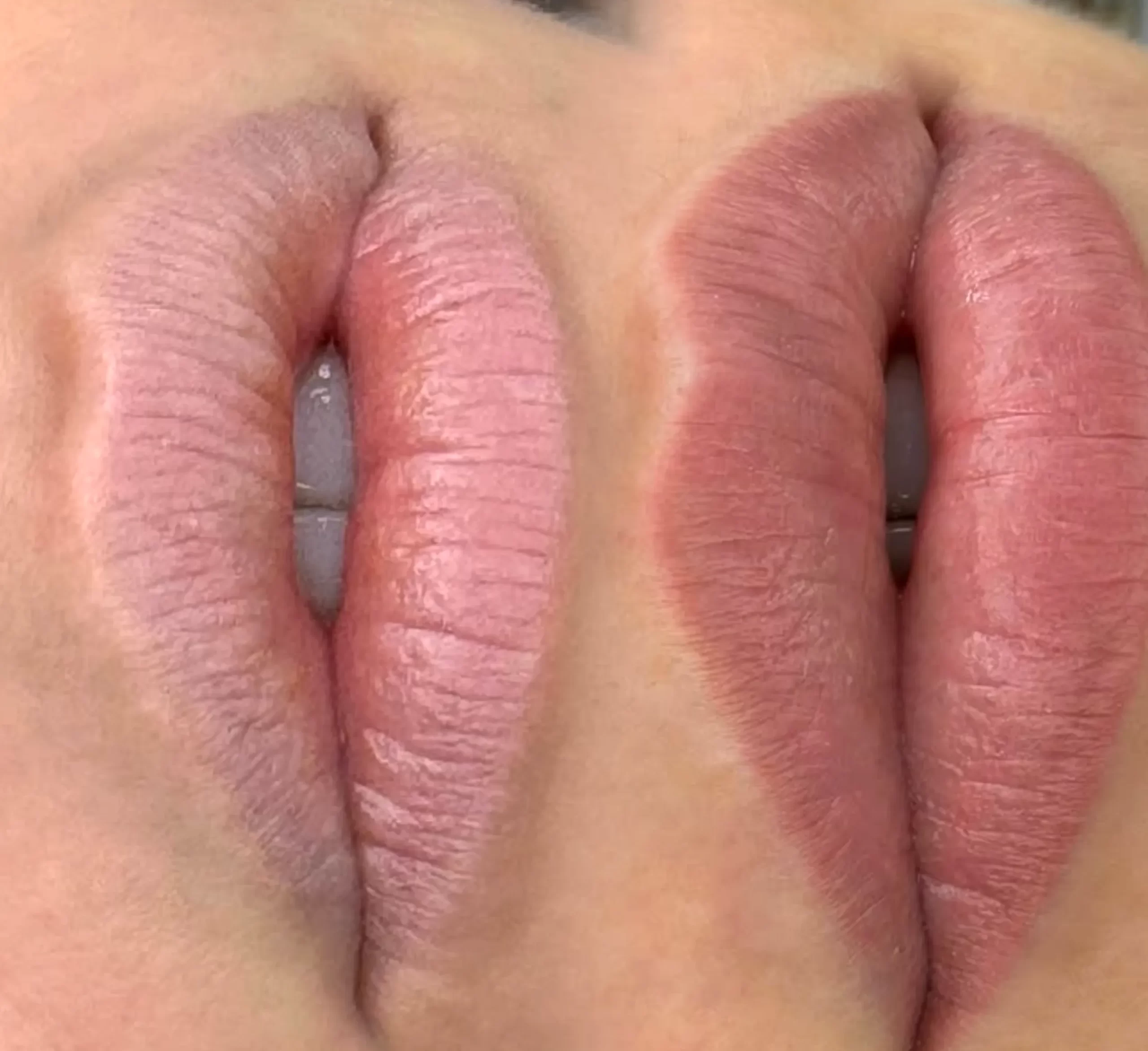 do I need ABN for lip tattoo course